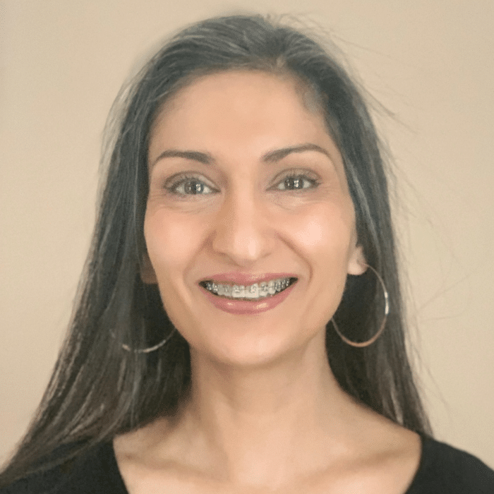 A person with long dark and grey hair smiles at the camera, wearing hoop earrings and braces on her teeth. She is wearing a black top and is in front of a plain beige background.